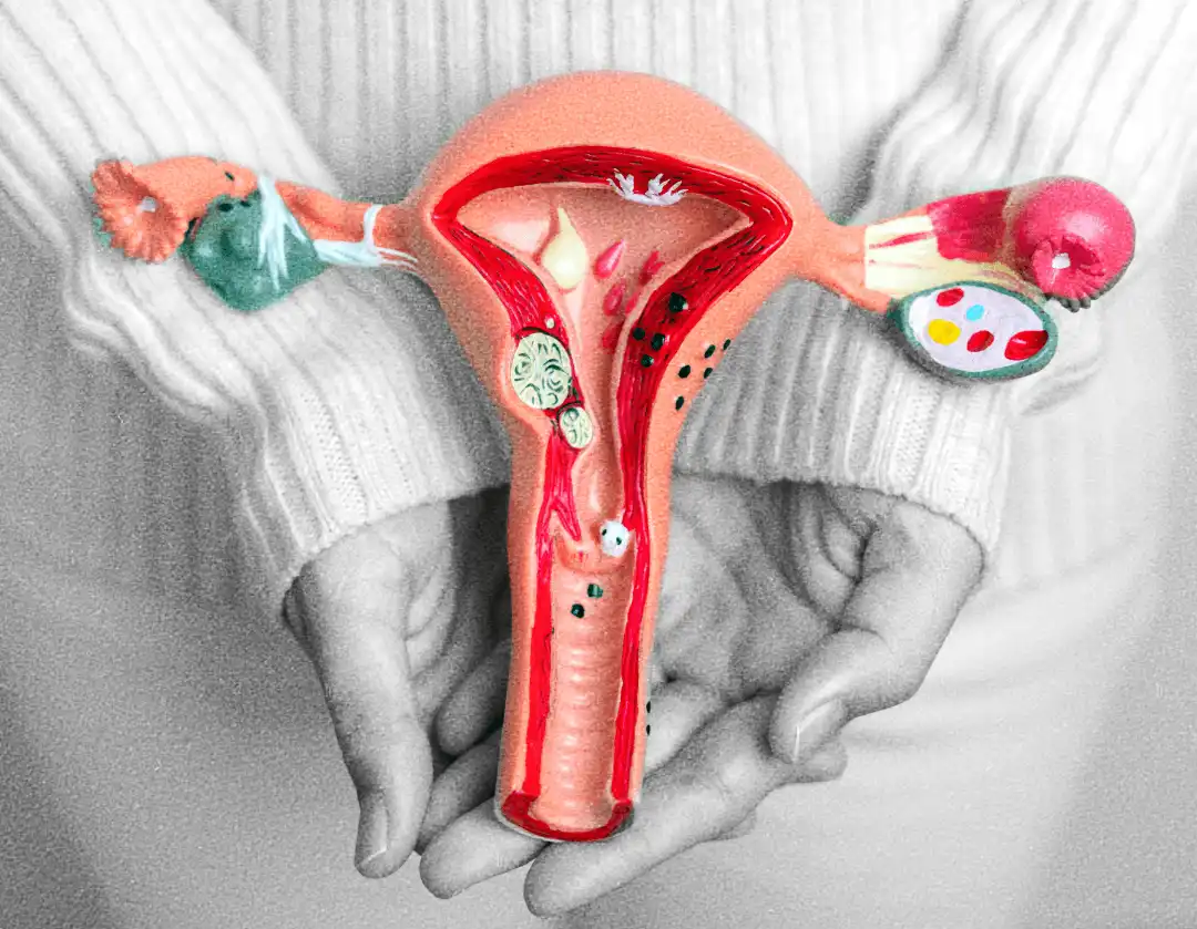 Ilustración de los órganos reproductivos de la mujer